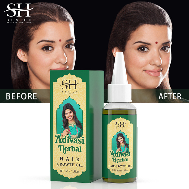 50ml Originale India Olio Adiv - Ayurvedic & Herbal Wellness Kits recensione e prezzo